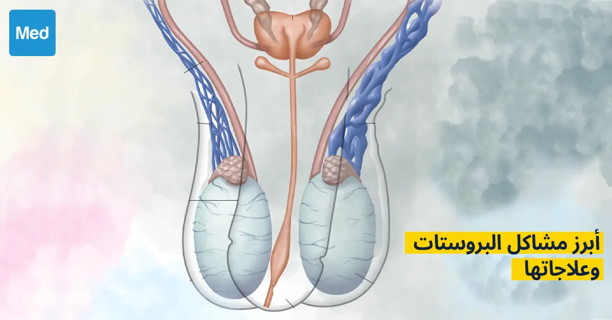 أبرز مشاكل البروستات وعلاجاتها